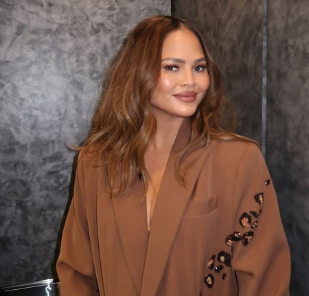 Why Chrissy Teigen says she’s gonna have the ‘worst black eye’?