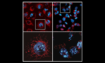 Study decodes why promising cancer treatments trigger serious side effects