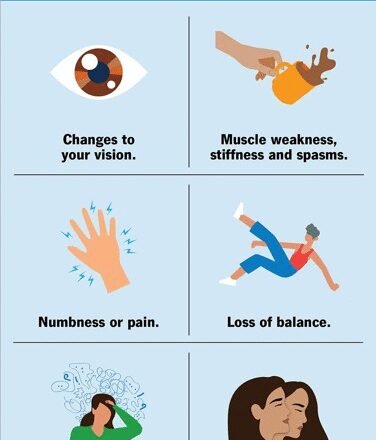 Multiple sclerosis may emerge a decade before neurological symptoms begin to appear