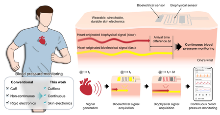 New bandage-like wearable monitor to enable continuous measurement of BP