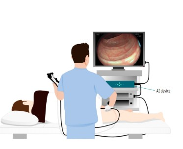 AI-assisted colonoscopies may raise deskilling risk among doctors: The Lancet