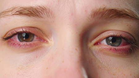 Just 1 hour of social media reels on smartphones can cause eye fatigue: Study